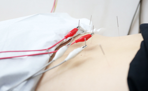 지방분해침 이미지